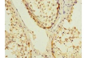 Immunohistochemistry of paraffin-embedded human testis tissue using ABIN7174484 at dilution of 1:100 (UBE2S antibody  (AA 1-222))