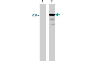Western blot analysis of A-431 cells serum starved overnight (lane 1) and treated with pervanadate (1mM) for 30 min (lane 2). (Integrin beta 4 antibody  (pTyr1526))