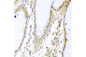 Immunohistochemistry of paraffin-embedded human stomach using MYBBP1A antibody (ABIN5972490) at dilution of 1/100 (40x lens). (MYBBP1A antibody)