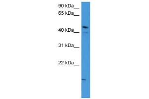 WB Suggested Anti-ZNF713 Antibody Titration: 0. (ZNF713 antibody  (N-Term))