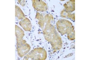 Immunohistochemistry (Paraffin-embedded Sections) (IHC (p)) image for anti-Insulin-Like Growth Factor 2 mRNA Binding Protein 3 (IGF2BP3) (AA 1-200) antibody (ABIN3016599)