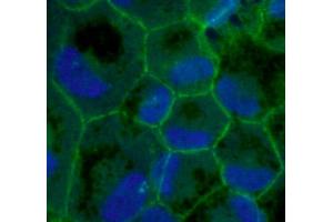 Immunofluorescence of primary RPE cells with ZO1 Ab at 1/100 dilution, (TJP1 antibody  (C-Term))