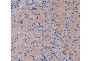 Used in DAB staining on fromalin fixed paraffin- embedded kidney tissue (IL17RE antibody  (AA 457-626))