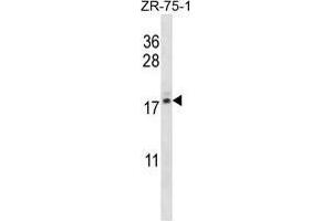 TNP2 Antibody (C-term) western blot analysis in ZR-75-1 cell line lysates (35 µg/lane). (TNP2 antibody  (C-Term))