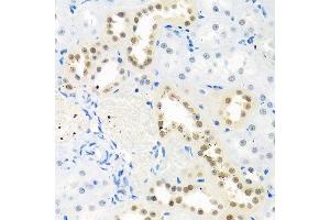 Immunohistochemistry of paraffin-embedded rat kidney using THOC1 antibody. (THOC1 antibody  (AA 428-657))
