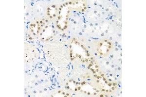 Immunohistochemistry of paraffin-embedded rat kidney using THOC1 antibody. (THOC1 antibody  (AA 428-657))