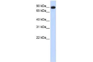 POSTN antibody used at 1 ug/ml to detect target protein. (Periostin antibody  (Middle Region))
