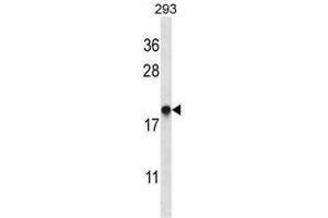 TMM85 Antibody (N-term) western blot analysis in 293 cell line lysates (35 µg/lane).