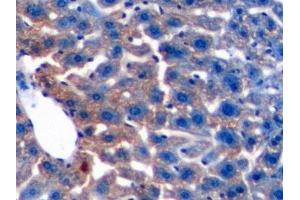 Detection of TGFb1 in Mouse Liver Tissue using Polyclonal Antibody to Transforming Growth Factor Beta 1 (TGFb1) (TGFB1 antibody  (AA 279-390))