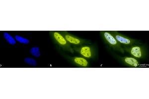 Immunocytochemistry/Immunofluorescence analysis using Rabbit Anti-Acetylated Lysine Polyclonal Antibody . (Lysine (lys) (acetylated) antibody (APC))