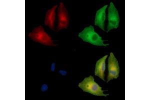 ABIN7095165 and ABIN7099221 staining  cells by IF/ICC.