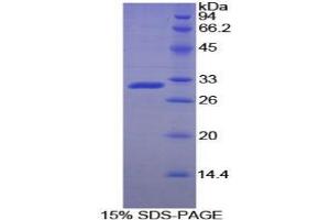 SDS-PAGE analysis of Rat ACP5 Protein. (ACP5 Protein)