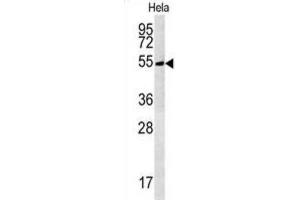 Western Blotting (WB) image for anti-tRNA Methyltransferase 11 Homolog (Trmt11) antibody (ABIN3002328) (Trmt11 antibody)