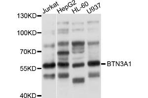 Western blot analysis of extracts of various cell lines, using BTN3A1 antibody (ABIN4903079) at 1:1000 dilution.