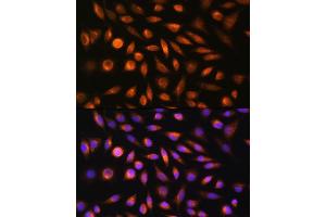 Immunofluorescence analysis of L929 cells using SH3PXD2A Rabbit pAb (ABIN6135104, ABIN6147731 and ABIN7101844) at dilution of 1:100. (SH3PXD2A antibody)