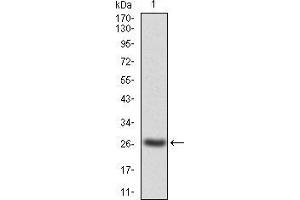 Western blot analysis using JAK2 mAb against human JAK2(AA: 745-955) recombinant protein. (JAK2 antibody  (AA 745-955))