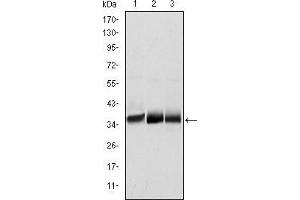 Western blot analysis using MSI2 mouse mAb against NTERA-2 (1), SW620 (2) and T47D (3) cell lysate. (MSI2 antibody)