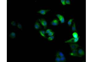 Immunofluorescence staining of Hela Cells with ABIN7127439 at 1:50, counter-stained with DAPI. (Recombinant CXCR4 antibody)
