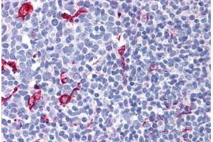 Human Tonsil (formalin-fixed, paraffin-embedded) stained with NET1 antibody ABIN299305 at 2. (NET1 antibody  (AA 611-624))