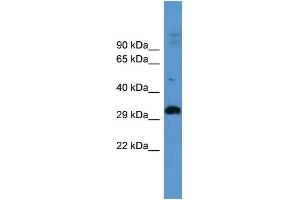 WB Suggested Anti-ADORA2B Antibody Titration: 0.