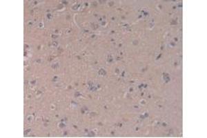 IHC-P analysis of Human Brain Tissue, with DAB staining. (TLR5 antibody  (AA 693-858))