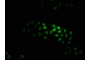 Immunofluorescence staining of Hela cells with ABIN7165725 at 1:100, counter-stained with DAPI. (KTI12 antibody  (AA 110-204))