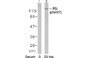 Image no. 1 for anti-Retinoblastoma 1 (RB1) (pSer807) antibody (ABIN196841) (Retinoblastoma 1 antibody  (pSer807))