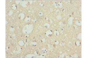 Immunohistochemistry of paraffin-embedded human brain tissue using ABIN7161608 at dilution of 1:100