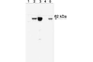 Western blot analysis of T-bet expressed by Mouse Th1 and Th2 cells and Human NK cell and T cell leukemia lines and Peripheral Blood Mononuclear Cells (PBMC). (T-Bet antibody)