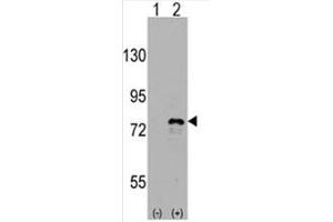 Image no. 2 for anti-DEAD (Asp-Glu-Ala-Asp) Box Polypeptide 3, X-Linked (DDX3X) (C-Term) antibody (ABIN357007)