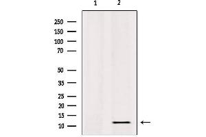 Western blot analysis of extracts from HepG2, using RPL36 Antibody. (RPL36 antibody  (C-Term))