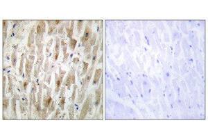 Immunohistochemistry (IHC) image for anti-LIM Domain Kinase 2 (LIMK2) (Internal Region) antibody (ABIN1849456) (LIMK2 antibody  (Internal Region))