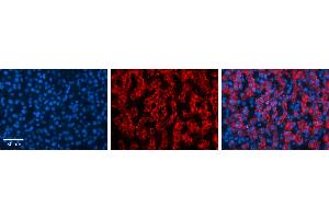 MAP2K3 antibody - C-terminal region          Formalin Fixed Paraffin Embedded Tissue:  Human Liver Tissue    Observed Staining:  Cytoplasm in hepatocytes   Primary Antibody Concentration:  1:100    Other Working Concentrations:  1/600    Secondary Antibody:  Donkey anti-Rabbit-Cy3    Secondary Antibody Concentration:  1:200    Magnification:  20X    Exposure Time:  0. (MAP2K3 antibody  (C-Term))