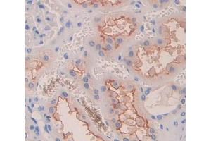 Figure. (Dysferlin antibody  (AA 1-479))