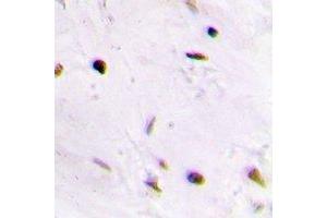 Immunohistochemical analysis of QDPR staining in human brain formalin fixed paraffin embedded tissue section. (QDPR antibody)