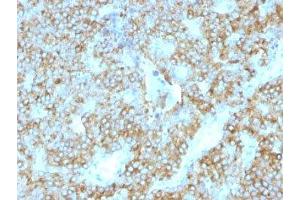 Formalin-fixed, paraffin-embedded human parathyroid stained with PTH antibody (PTH/1175). (PTH antibody  (AA 32-115))