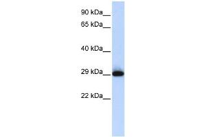 SUSD3 antibody used at 1 ug/ml to detect target protein.