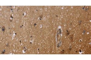 Immunohistochemistry of paraffin-embedded Human brain using FHL3 Polyclonal Antibody at dilution of 1:40 (FHL3 antibody)