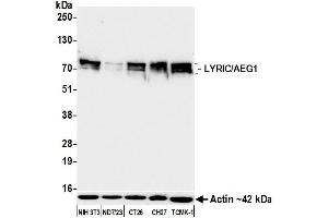Western Blotting (WB) image for anti-Metadherin (MTDH) (AA 475-525) antibody (ABIN7795652)