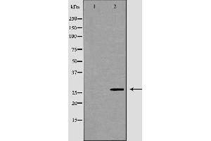 Western blot analysis of Hela whole cell lysates, using VAPB Antibody. (VAPB antibody  (C-Term))