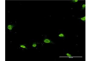 Immunofluorescence of monoclonal antibody to PSMB8 on HeLa cell. (PSMB8 antibody  (AA 173-272))