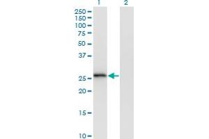 Western Blot analysis of MS4A6A expression in transfected 293T cell line by MS4A6A monoclonal antibody (M02), clone 2D12. (MS4A6A antibody  (AA 1-248))
