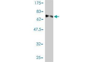 Western Blot detection against Immunogen (73. (E2F8 antibody  (AA 1-431))