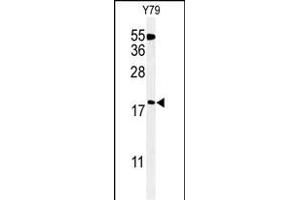 Western blot analysis of TXNDC12 Antibody (C-term) (ABIN651065 and ABIN2840056) in Y79 cell line lysates (35 μg/lane). (TXNDC12 antibody  (C-Term))