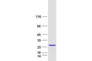Validation with Western Blot (C11orf73 Protein (Transcript Variant 1) (Myc-DYKDDDDK Tag))