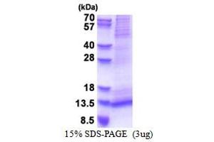 Receptor (G Protein-Coupled) Activity Modifying Protein 1 (RAMP1) (AA 27-117) protein (His tag)