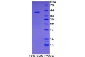 SDS-PAGE (SDS) image for Glial Fibrillary Acidic Protein (GFAP) (AA 70-374) protein (His tag) (ABIN2124957)