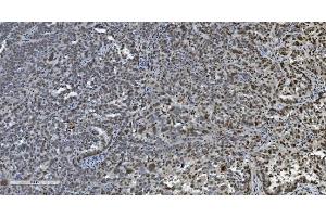 IHC analysis of Transketolase/TKT using anti-Transketolase/TKT antibody (ABIN7598958). (TKT antibody  (AA 1-116))