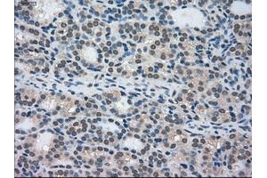 Immunohistochemical staining of paraffin-embedded Ovary tissue using anti-STK39mouse monoclonal antibody. (STK39 antibody)