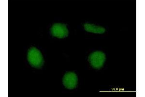 Immunofluorescence of purified MaxPab antibody to NET1 on HeLa cell. (NET1 antibody  (AA 1-542))